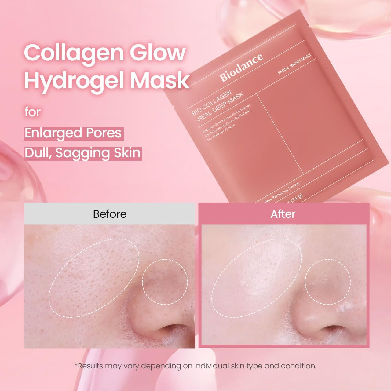 BIODANCE Bio-Collagen Real Deep Mask, Hydrating Overnight Hydrogel Mask, Pore Minimizing, Elasticity, Plumping Improvement, Korean Skincare | 1.19oz(34g) x 4ea